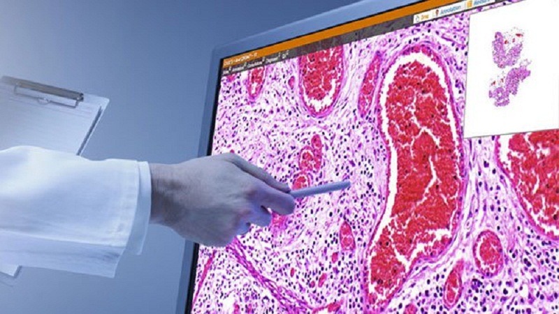 Pathology